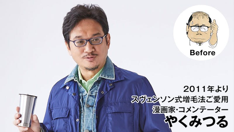 やくみつる 著名人ユーザーボイス 男性用ファッションウィッグ かつら 増毛や薄毛対策のメンズスヴェンソン